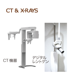 CTとレントゲン