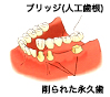 無料相談