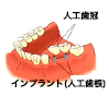 無料相談